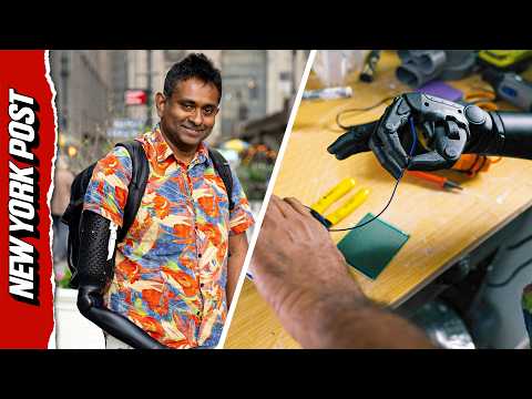 Bronx Physicist Becomes First To Receive Life-Altering 3D-Printed Robo-Arm