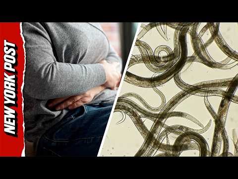 U.S. Hit by Mysterious Diarrhea-Causing Parasite